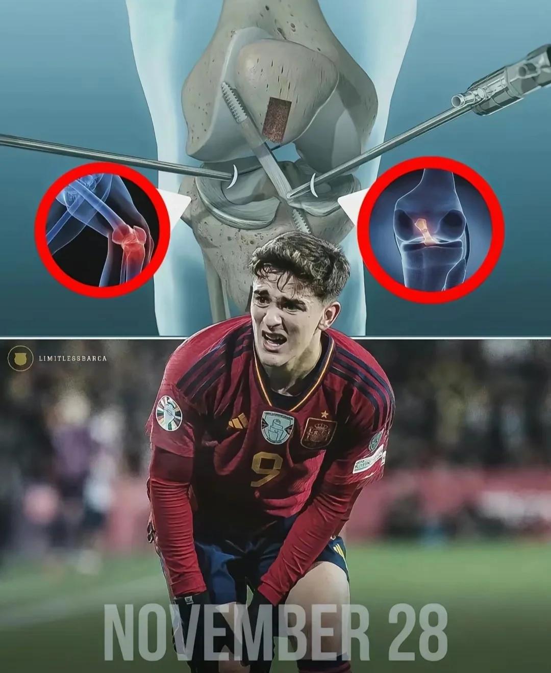 KOK体育-斯图加特球员紧急受伤，或将缺席比赛(斯图加特主力球员)